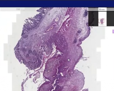 Tıbbi Patoloji Eğitimi Çevrim İçi Gerçekleşti 